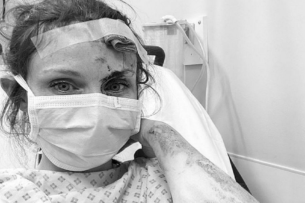 Певица Софи Эллис-Бекстор госпитализирована с травмами головы