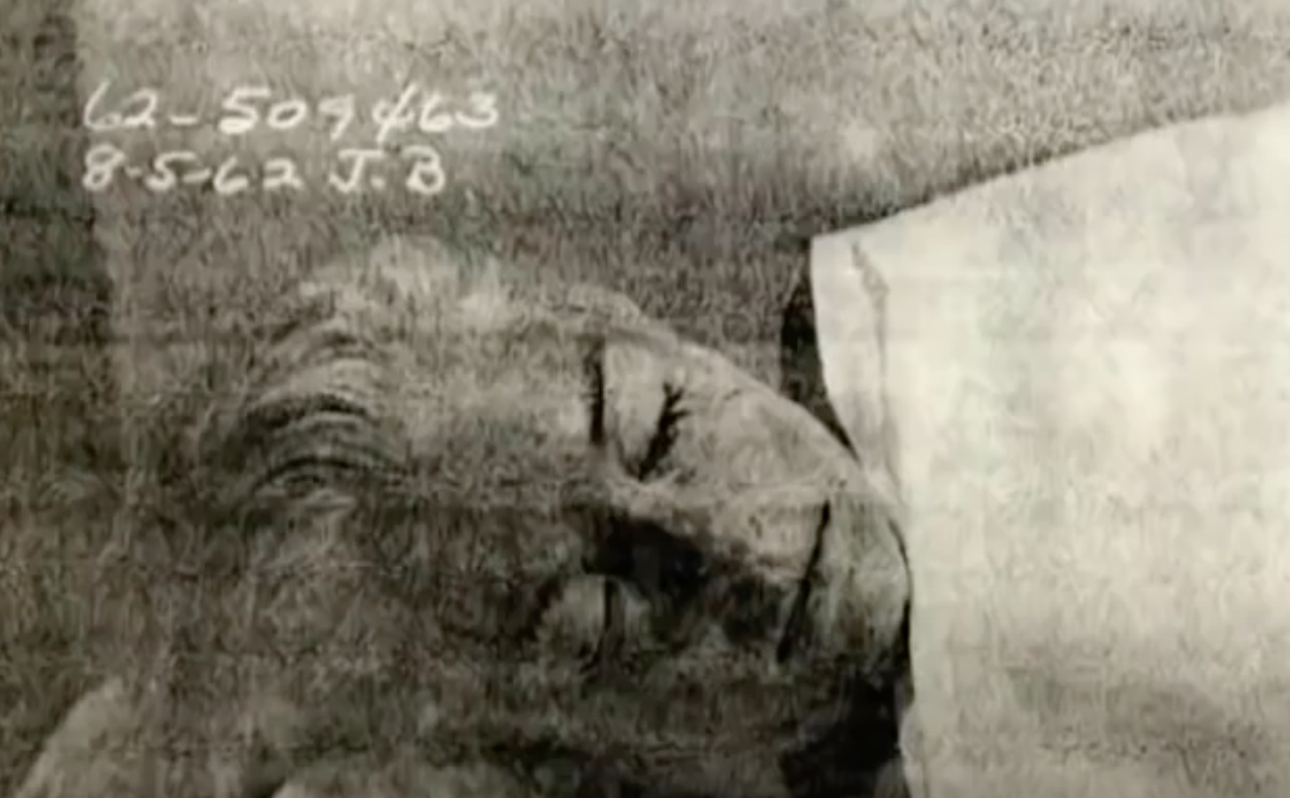 Marilyn Monroe Deathbed