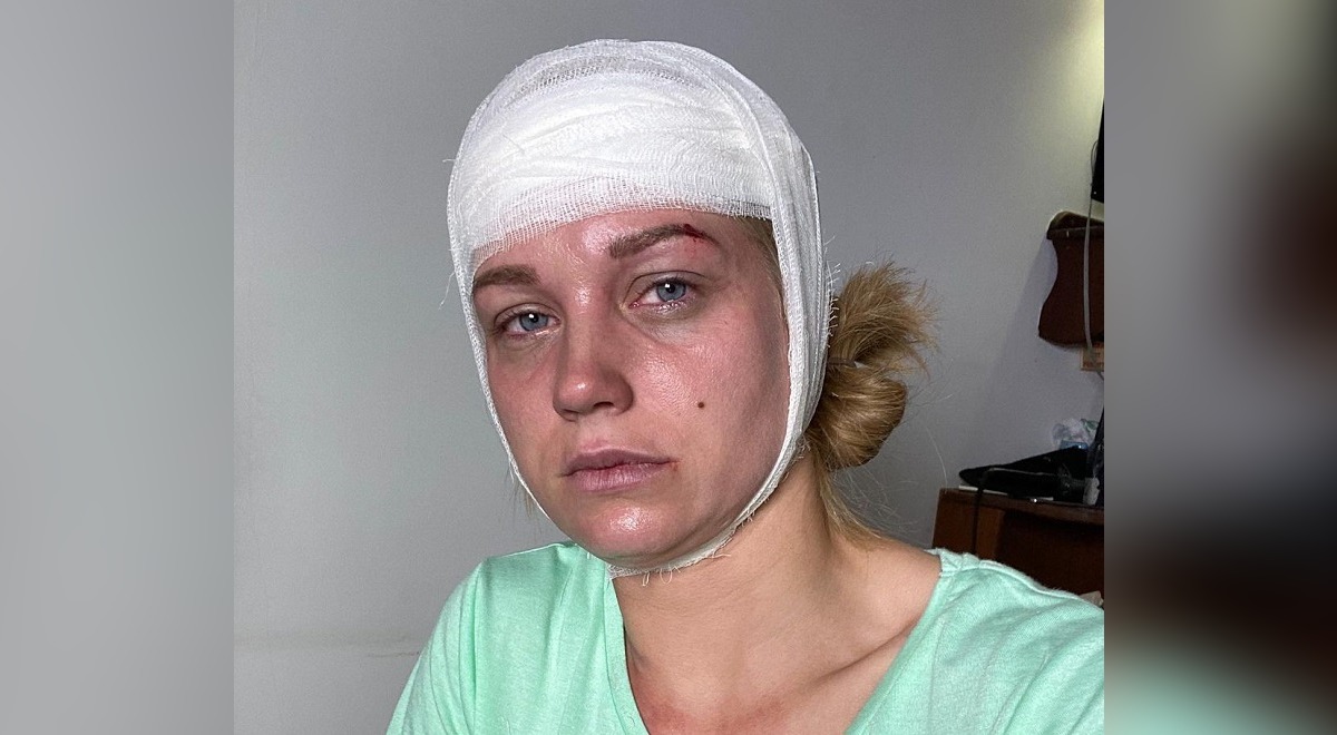 Избитая Кристина Асмус опубликовала кадры из больницы: «Гарик вернулся»